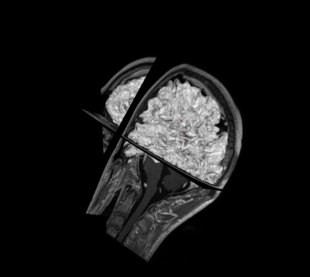 BrainFocus