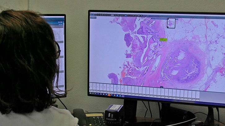 Patòloga visualitzant mostres histopatològiques a través de les eines desenvolupades per DigiPatICS. Autoria: Vall d'Hebrón